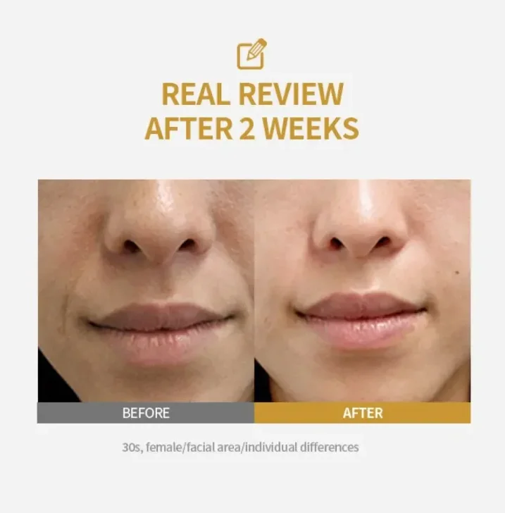{title} product – view 2