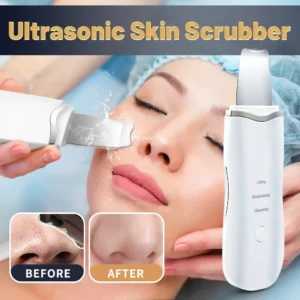 Rechargeable Facial Skin Scrubber — ion deep-cleansing device, SKU SHR-AE-3256807693775500