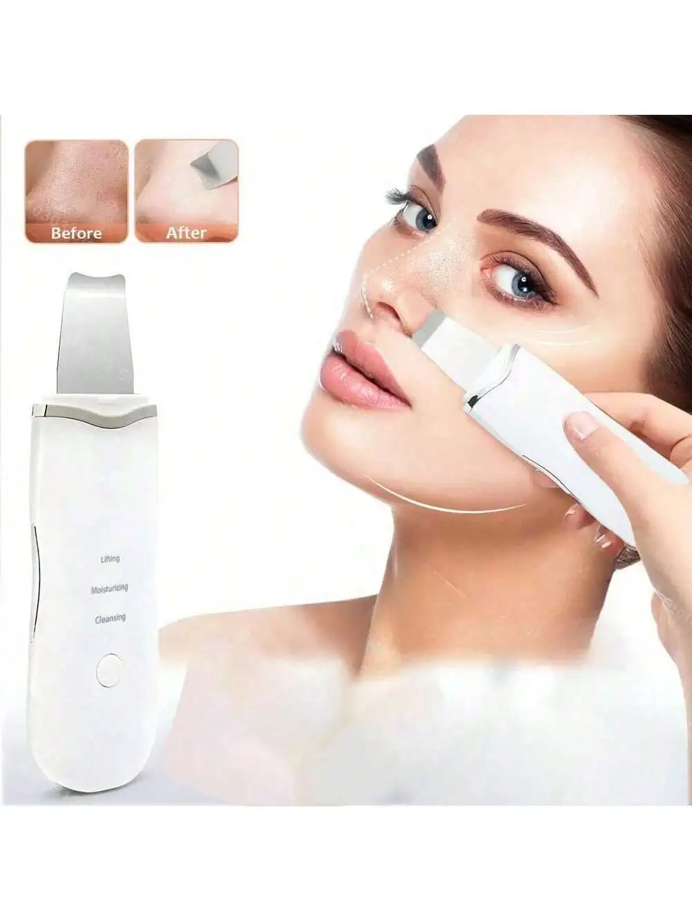 Ultrasonic Skin Scraper — Rechargeable pore cleaner on white background – view 2
