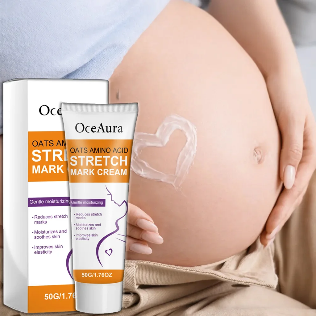 Stretch Mark Body Cream — lightening and firming body moisturizer on white background – view 3