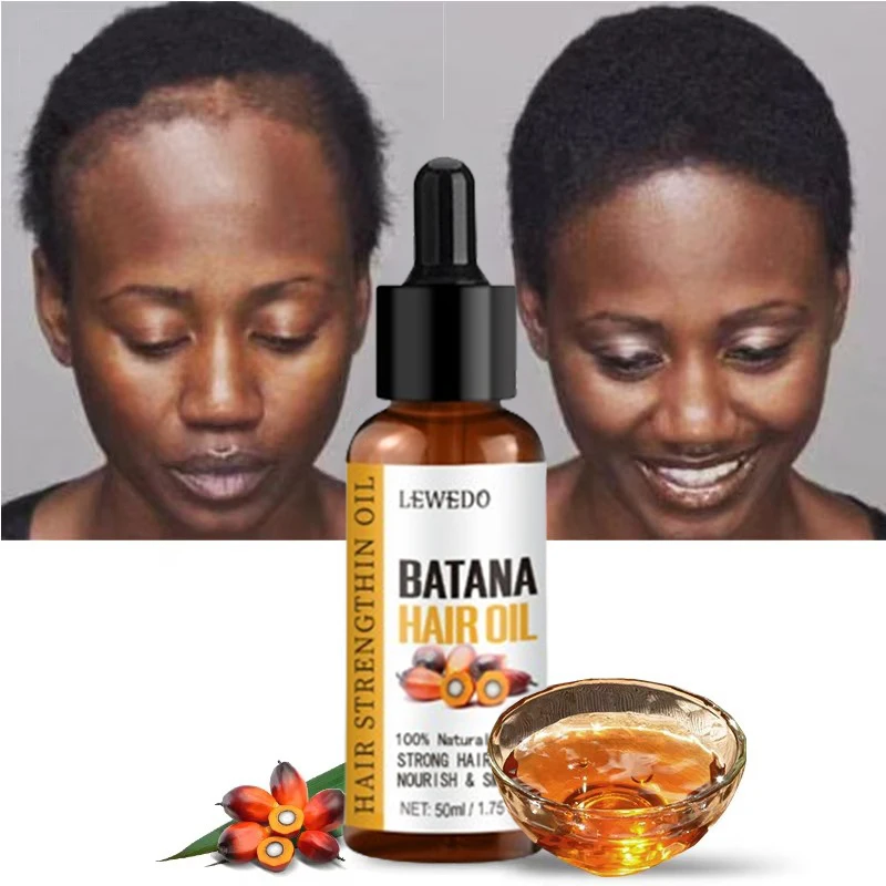Lewedo Naturals Pure Batana Oil bottle — product image showing label and oil – view 4