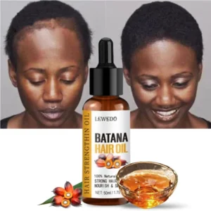 Lewedo Naturals Pure Batana Oil bottle — product image showing label and oil