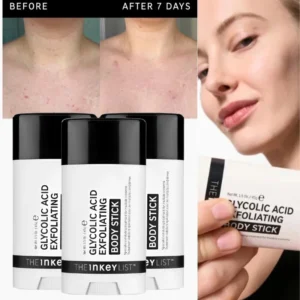 Glycolic Acid Body Roll‑On Stick — roll‑on applicator shown on forearm